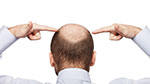 Hair Loss treatment Malaysia