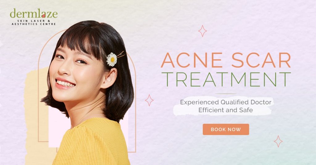 certified doctor for acne scar treatment
